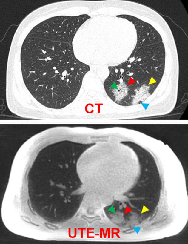 FIGURE 2