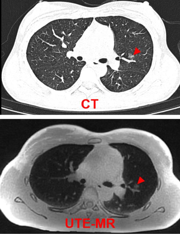 FIGURE 1