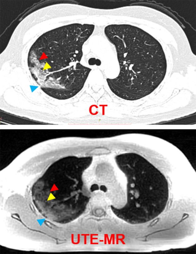 FIGURE 3