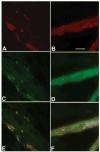 Fig 11