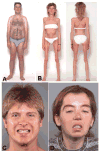 Fig 1
