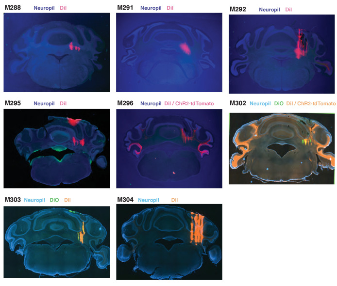 Figure 3—figure supplement 4.