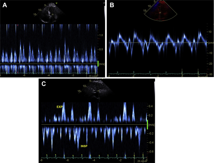 Figure 2