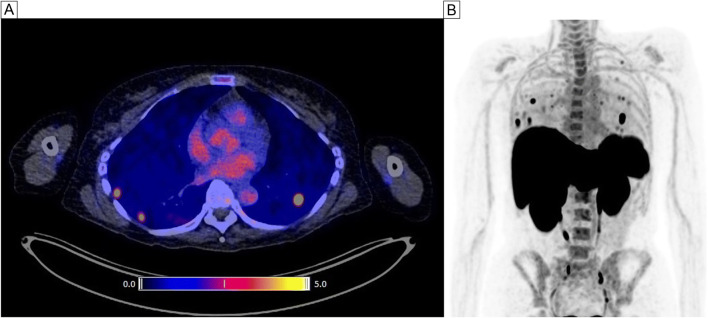 Fig. 2