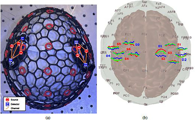 Fig 10