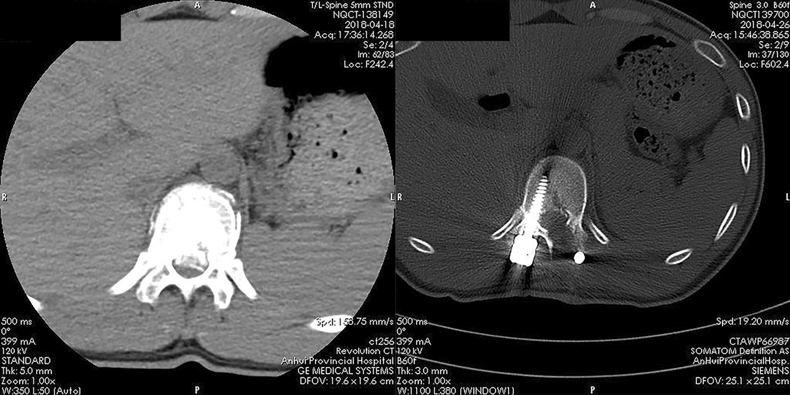 Fig. 4