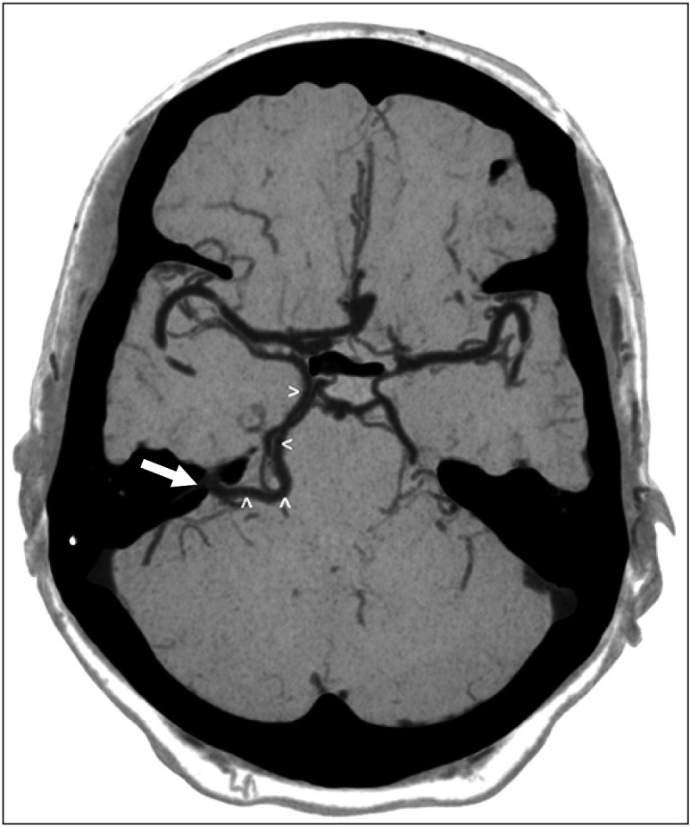 Fig. 5