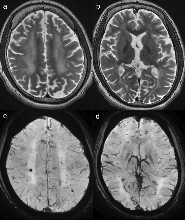 Fig. 10