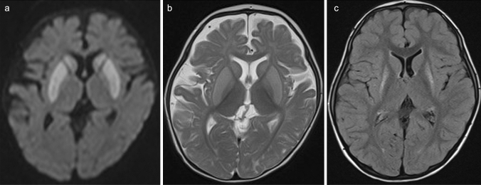 Fig. 12