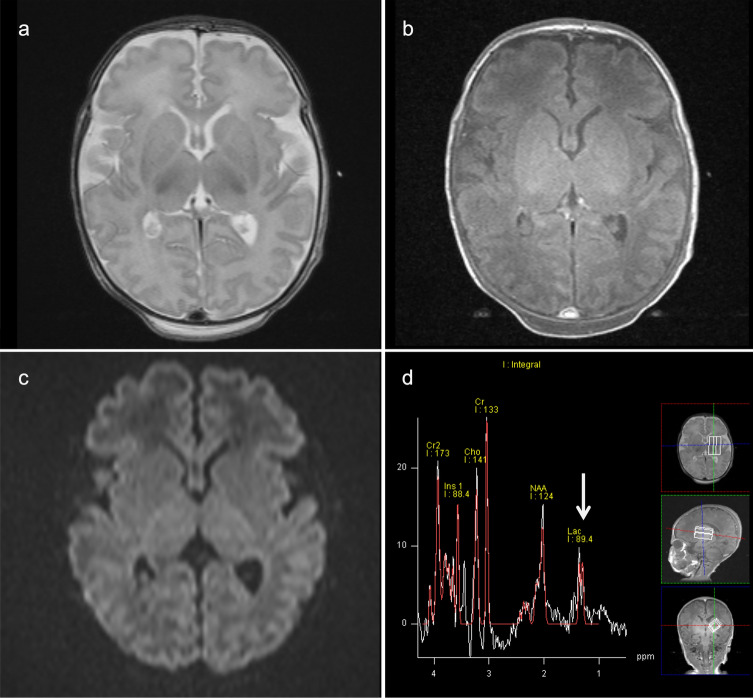 Fig. 13