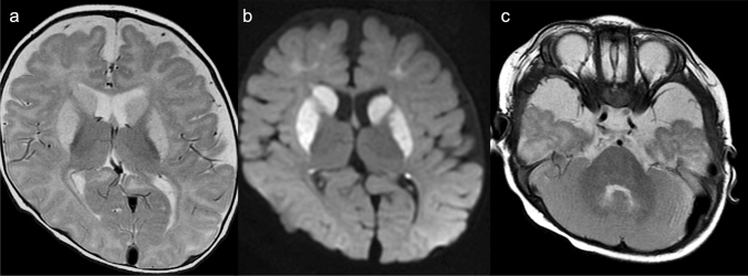 Fig. 15