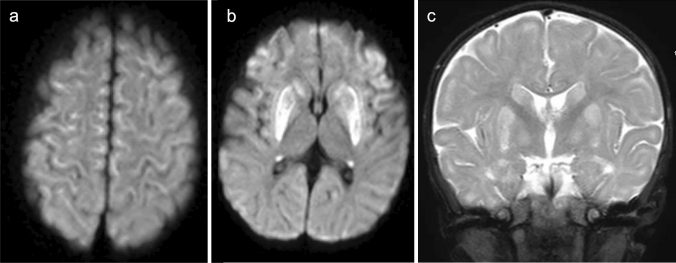 Fig. 11