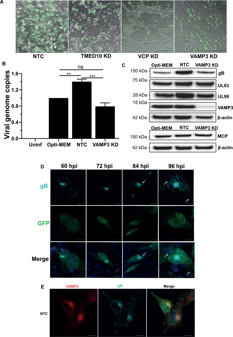 Figure 5—figure supplement 1.