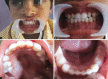 Figs 3A to D