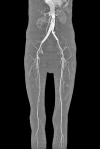 Figure 3-4