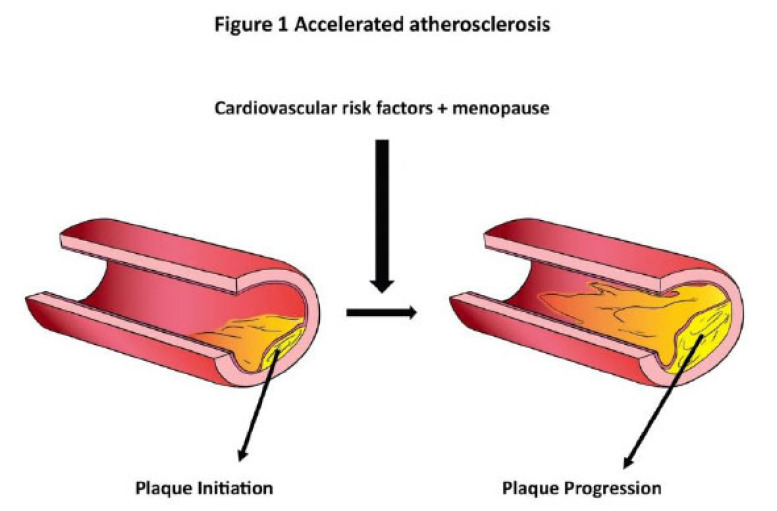 Fig. (1)