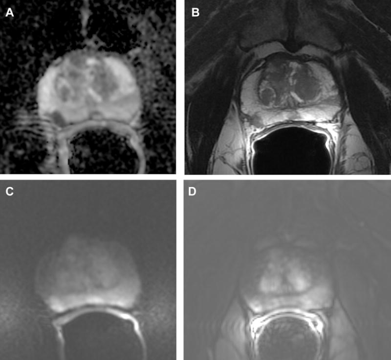 Fig.3