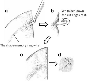 Fig. 5