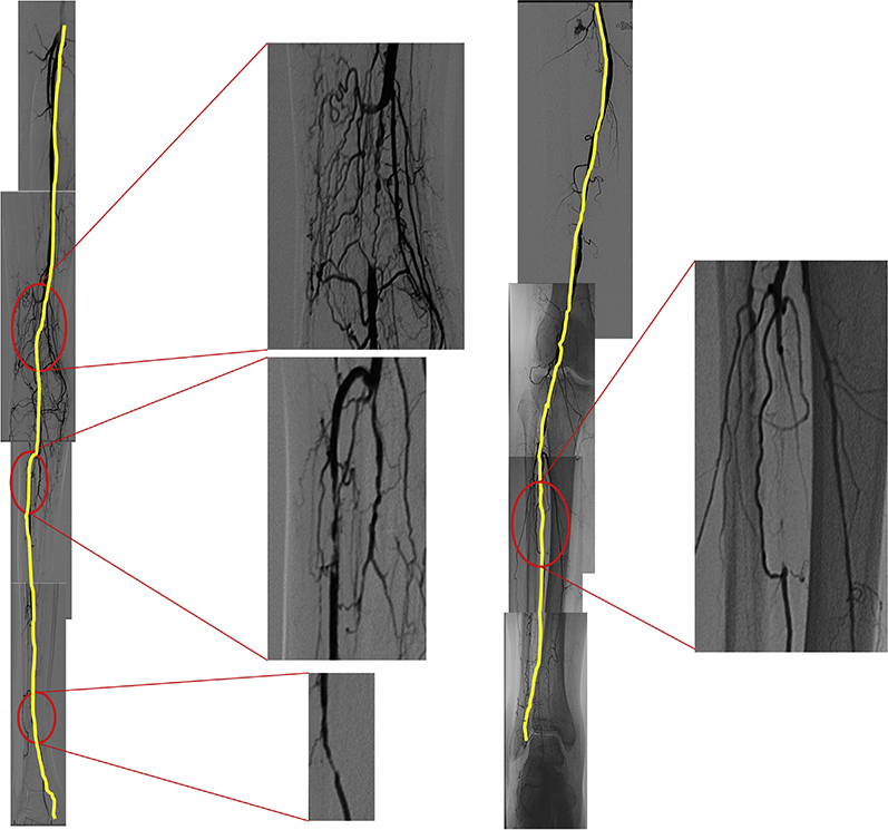 Fig 5.5.