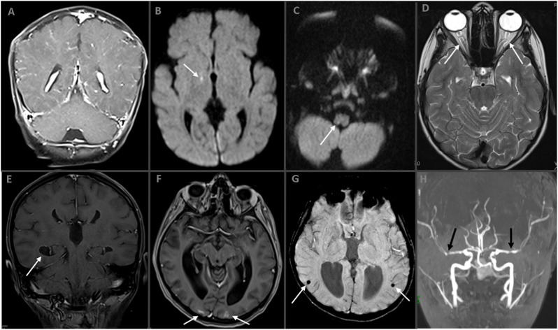 Fig. 2