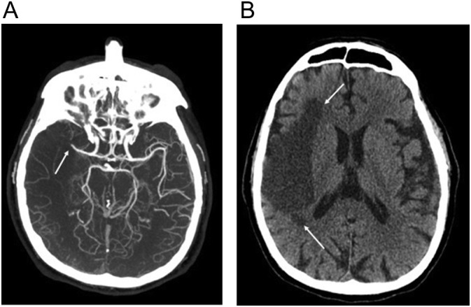 Fig. 7