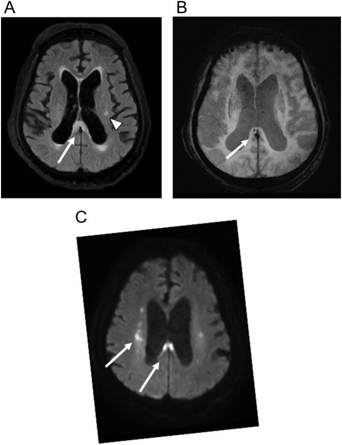 Fig. 12