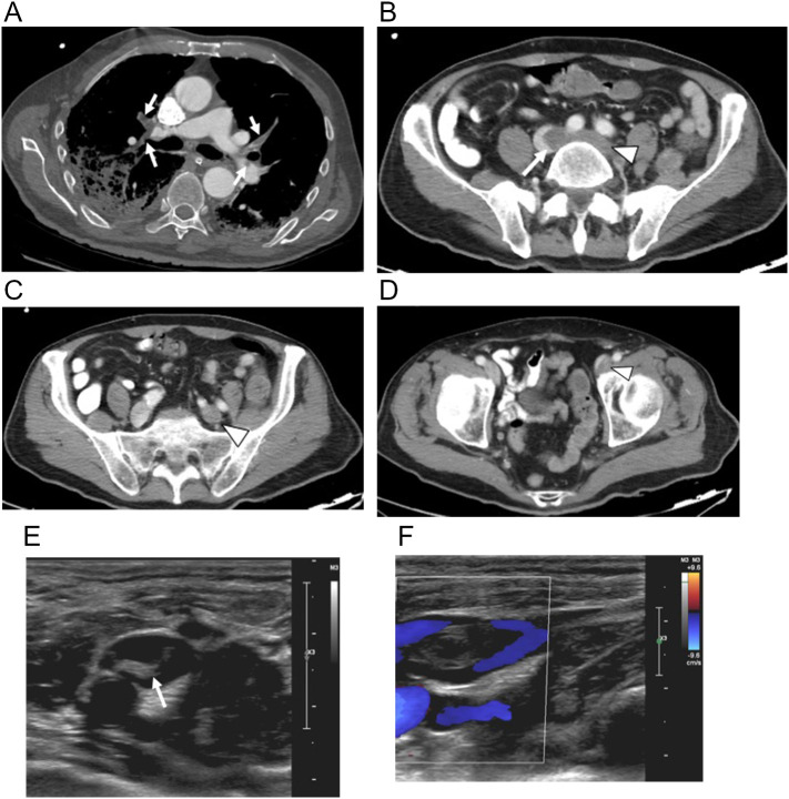 Fig. 18