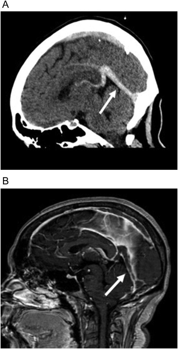 Fig. 15