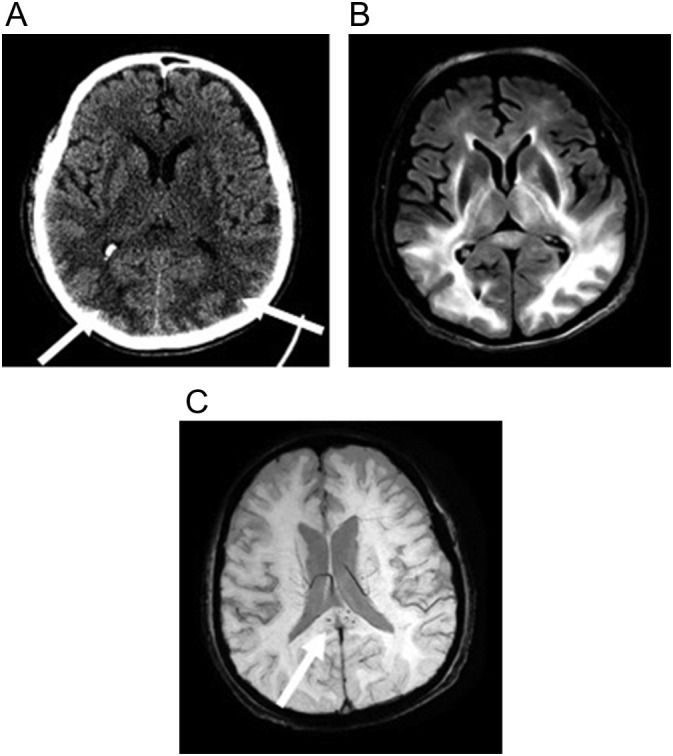 Fig. 13