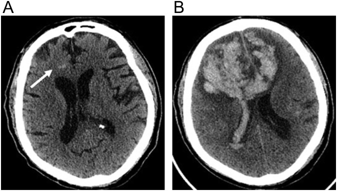 Fig. 10