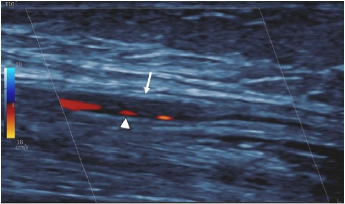 Fig. 17