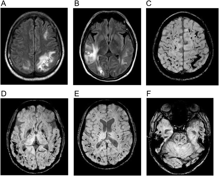 Fig. 14