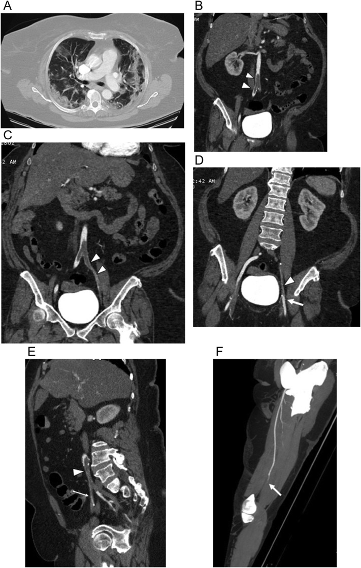 Fig. 19