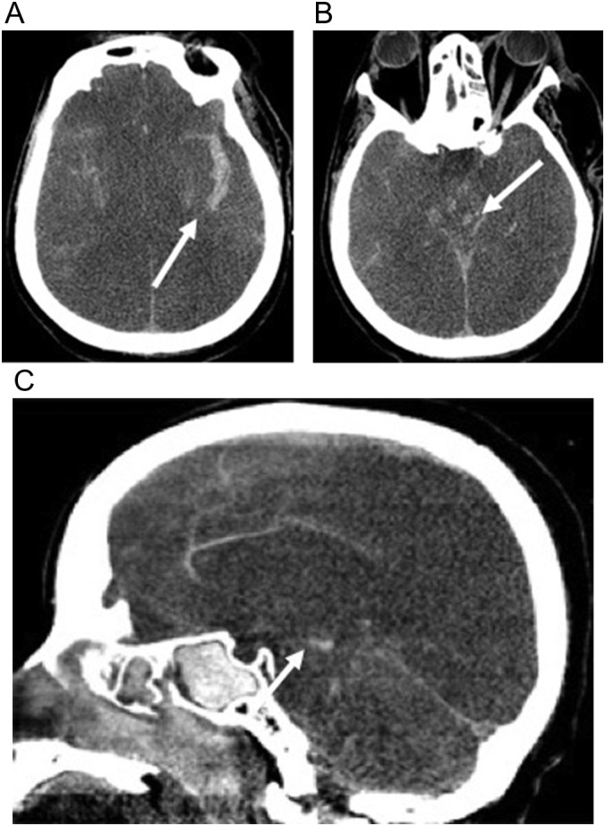 Fig. 16