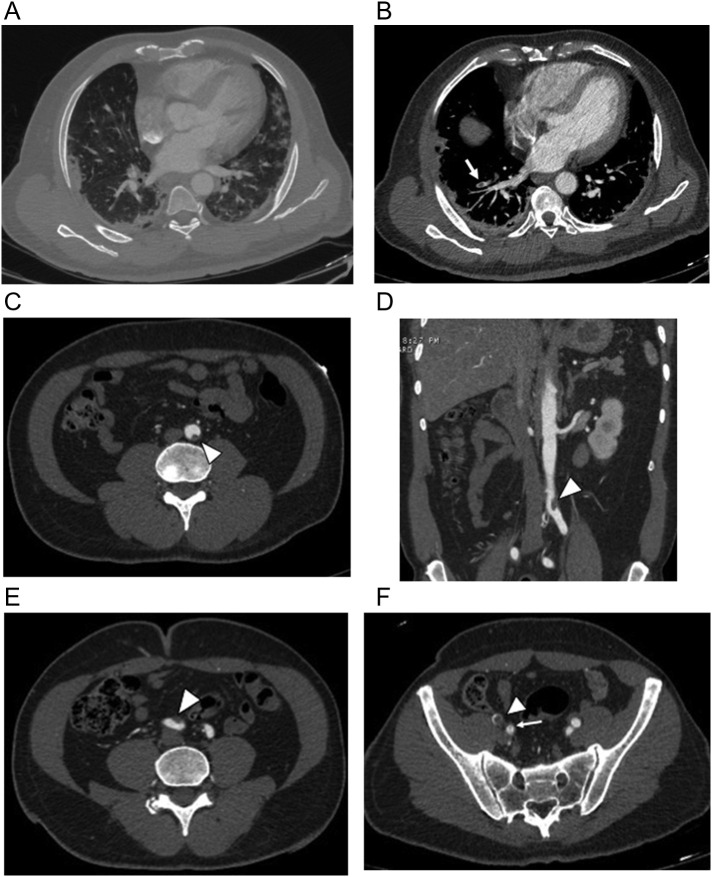 Fig. 20