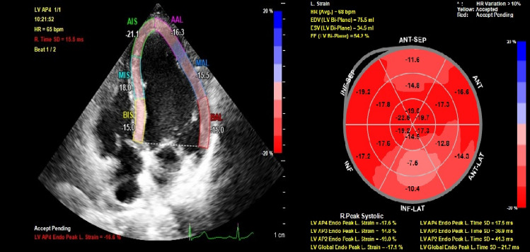 Fig. 2