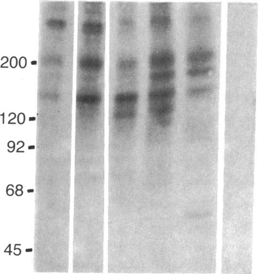 graphic file with name pnas00335-0382-a.jpg