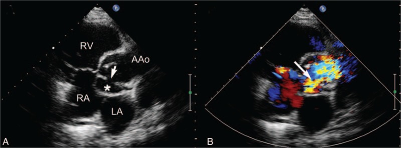 FIGURE 3