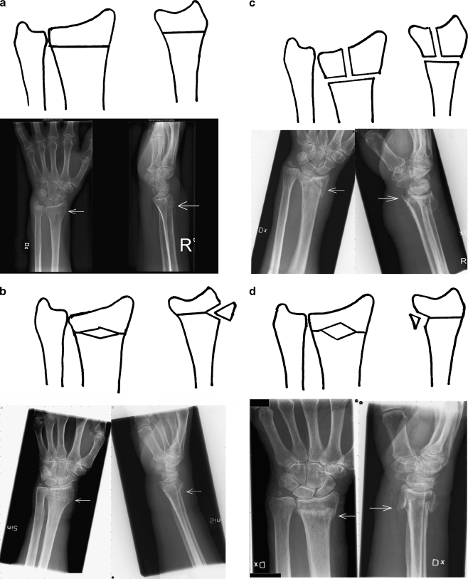 Figure 1