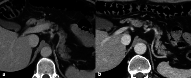 Fig. 18