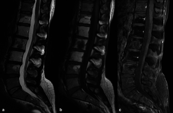 Fig. 25