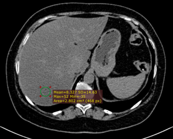 Fig. 14