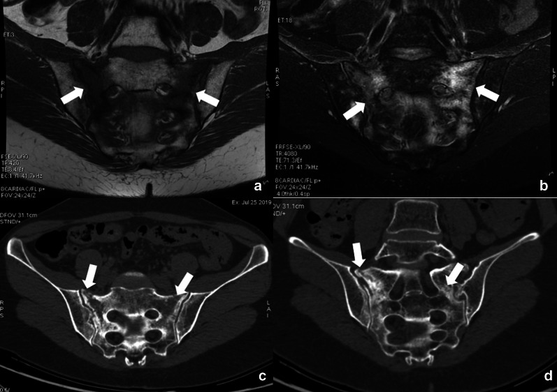 Fig. 26