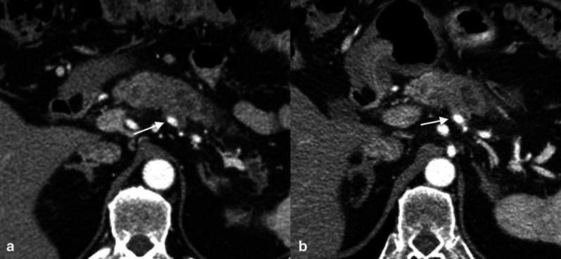 Fig. 19