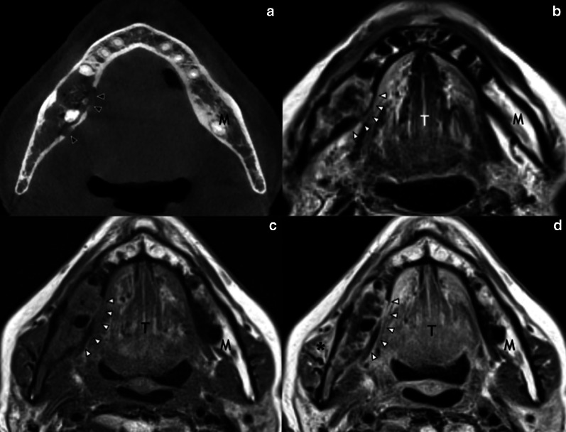 Fig. 10