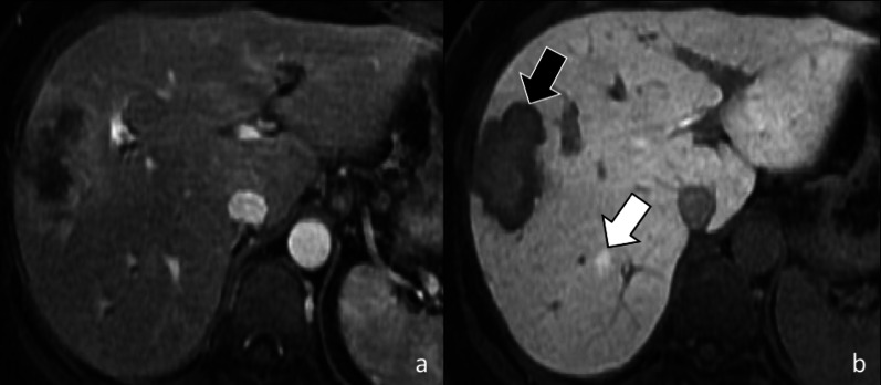 Fig. 16