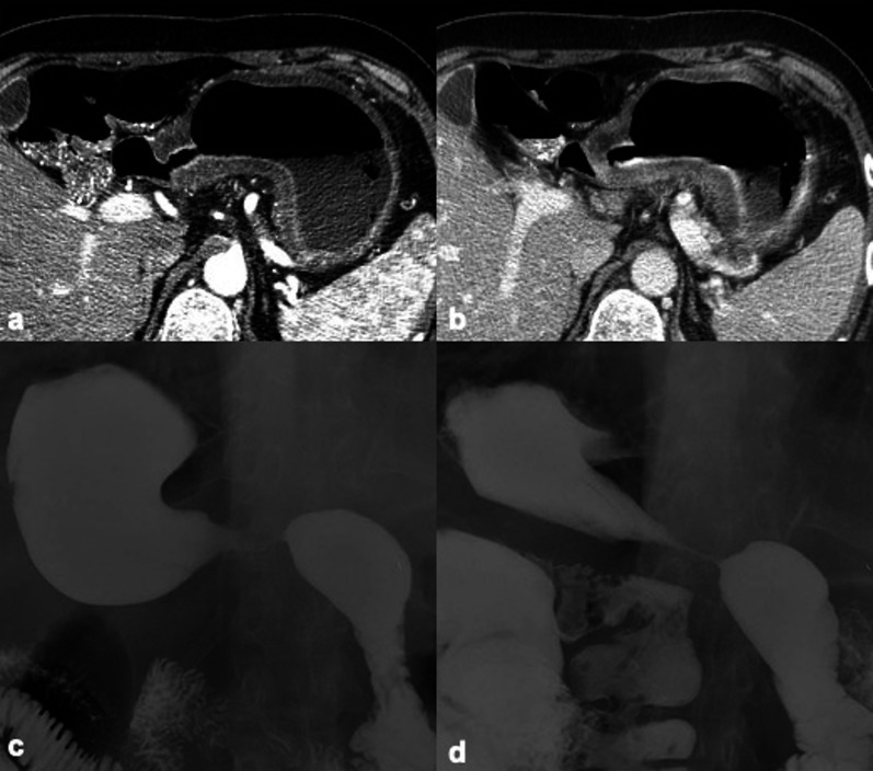 Fig. 20