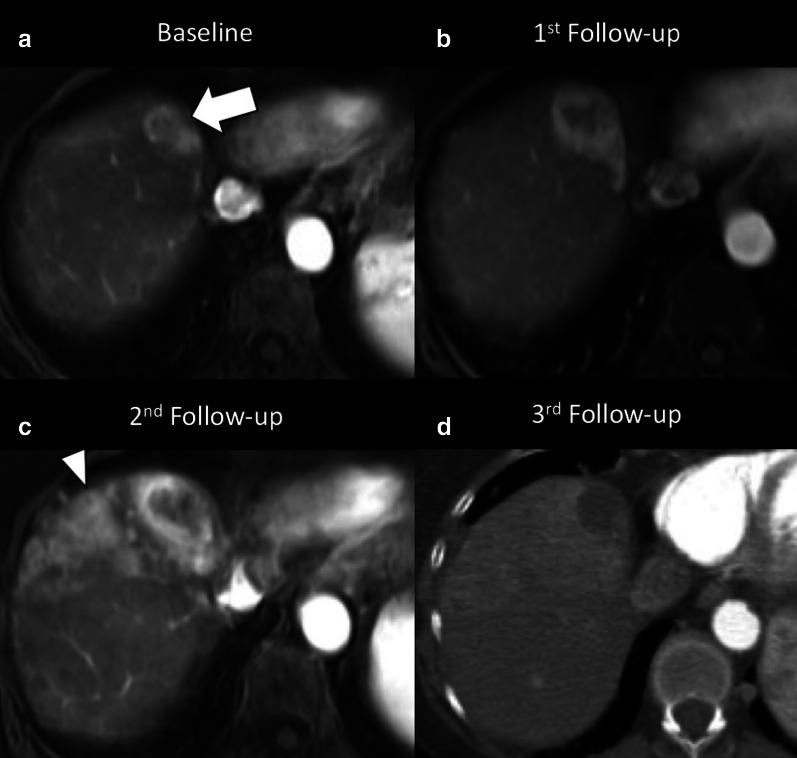 Fig. 17