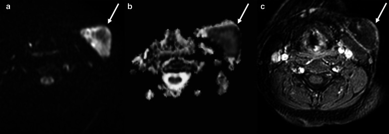 Fig. 24