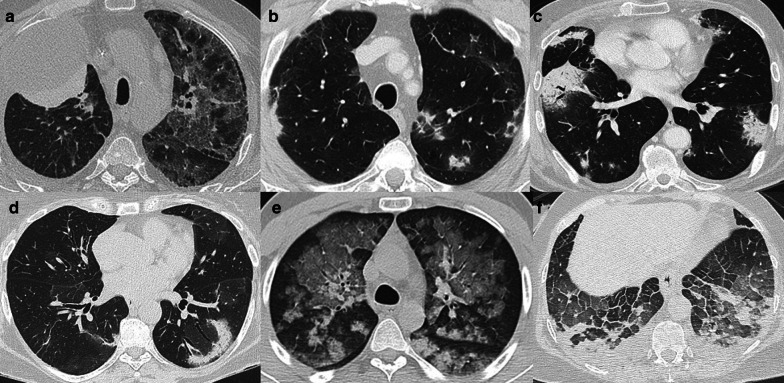 Fig. 12